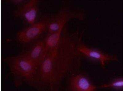 Immunocytochemistry/ Immunofluorescence: RelA/NFkB p65 [p Ser536] Antibody [NB100-82088]